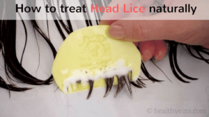 how to treat head lice naturally