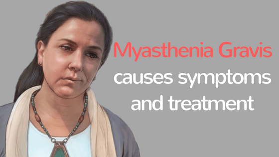 Myasthenia gravis causes symptoms and treatment